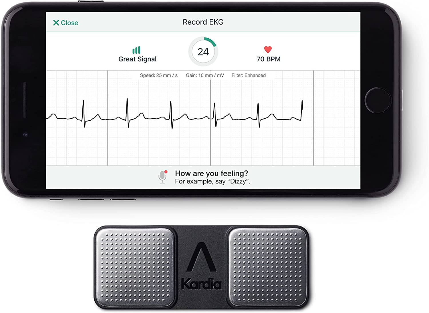 AliveCor KardiaMobile, ECG via smartphone a 155€